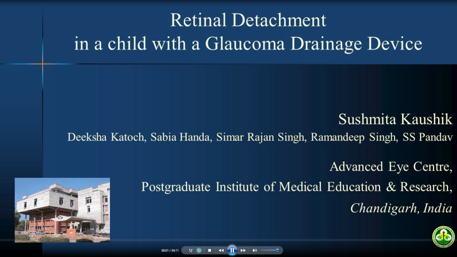 3 - Sushmita Kaushik - Retinal detachment in a child with a glaucoma drainage device: Use the implant!